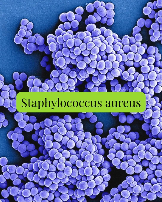 Colorized microscopy image showing clusters of round Staphylococcus aureus bacterial cells in shades of purple against a blue background. A bright green label reads “Staphylococcus aureus.”